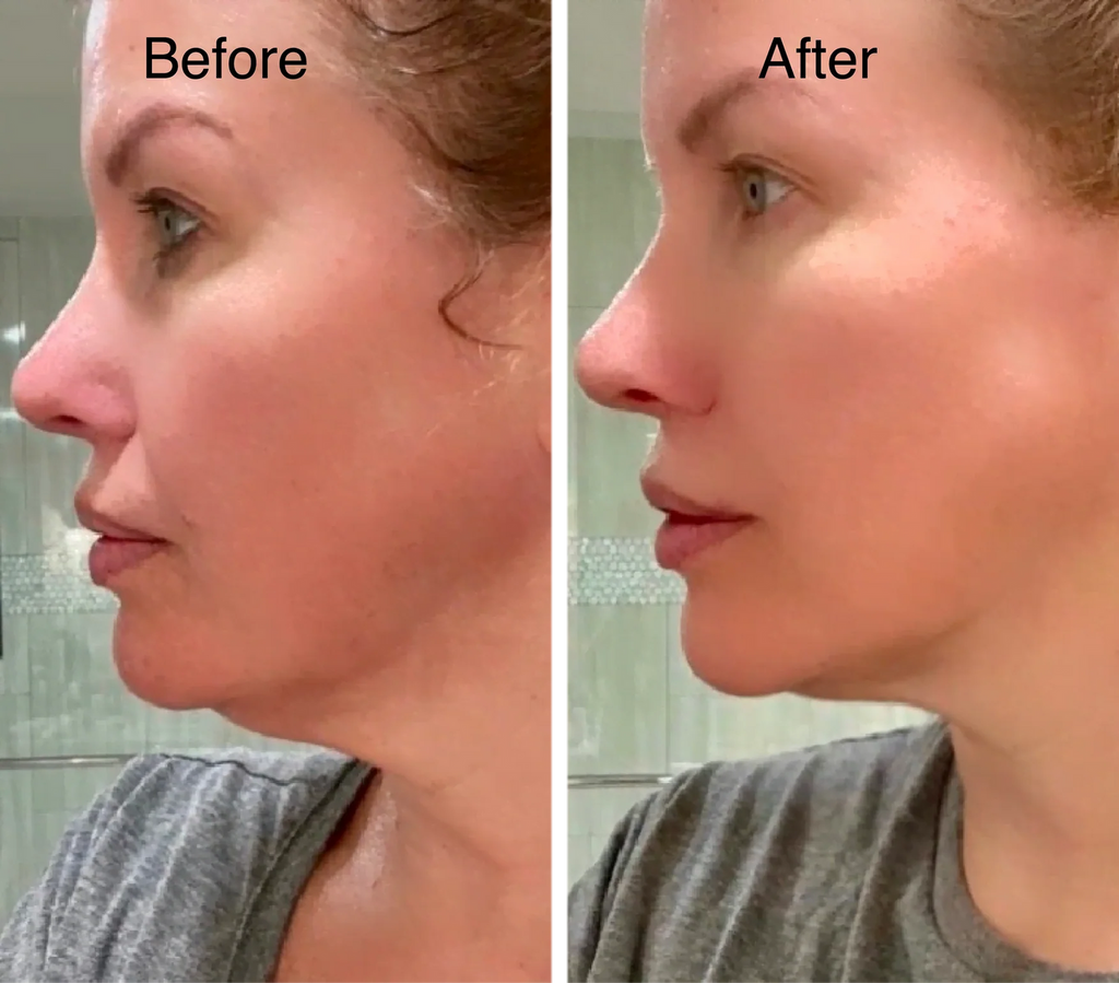 Lymphatic Face Brush