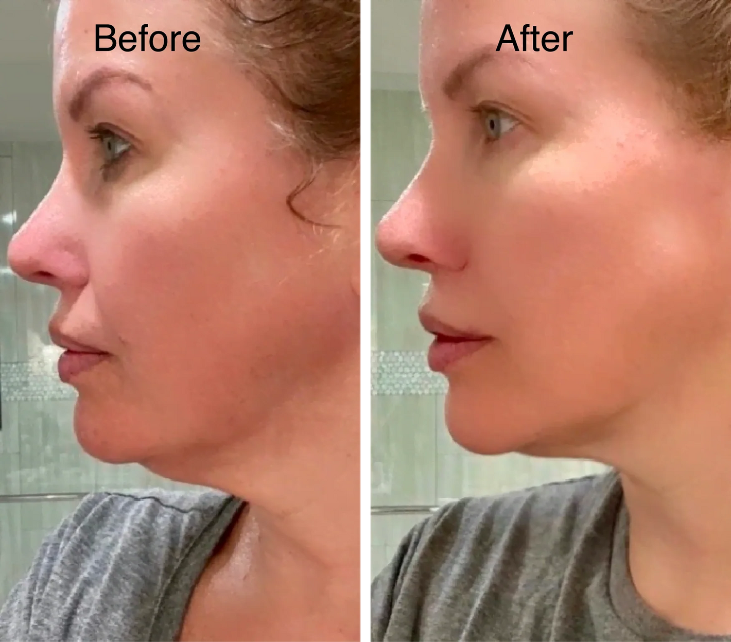 Lymphatic Face Brush